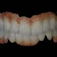 🦷قٌنآة بَيشُنت جٍآمعٍآت آلُِعٍرٍآقٌ 🦷 WhatsApp Channel
