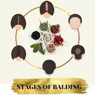 Stages Of Balding WhatsApp Channel