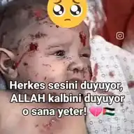 GAZZE DE KATLİYAM VAR WhatsApp Channel
