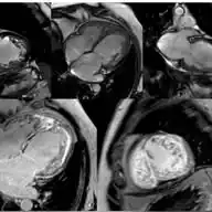 Bhavin Jankharia's Posts - Mainly Radiology, Sometimes Non-Radiology and Non-Medical WhatsApp Channel