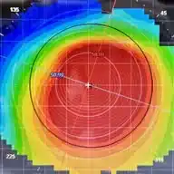 القرنية المخروطية / keratoconus WhatsApp Channel