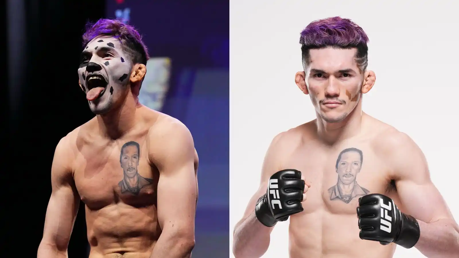 Image from UFC: Representing every child with vitiligo 👊  During the <a class="text-b...