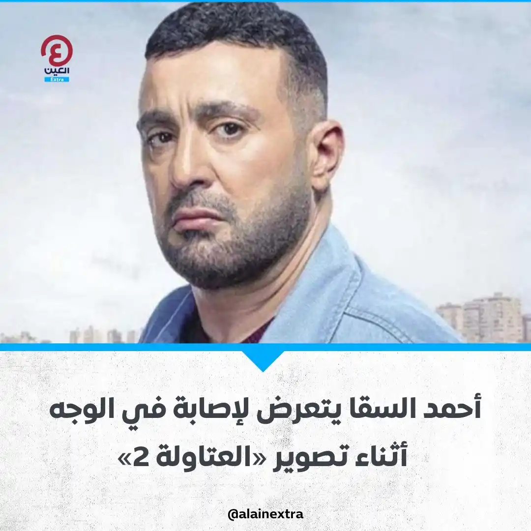 Image from العين EXtra: نقل الفنان المصري أحمد السقا إلى المستشفى بعد تعرضه لإصابة في الوجه أث...
