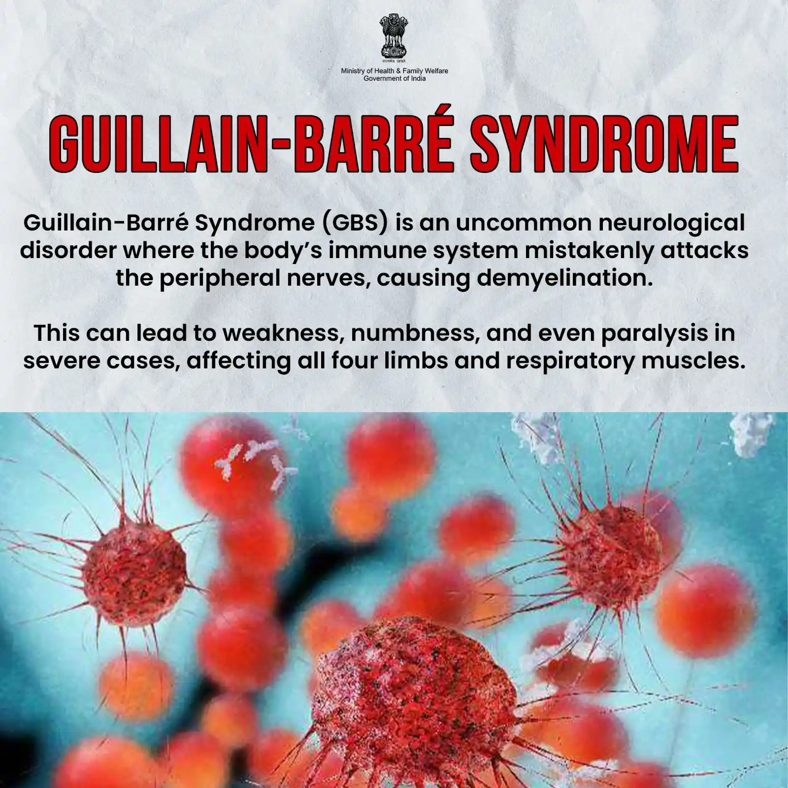Image from Ministry of Health & Family Welfare, GoI: Guillain-Barré Syndrome (GBS) can impact the peripheral nervous system...