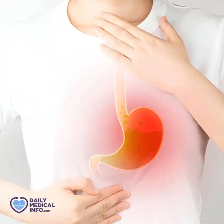 Image from اخبار واعلانات 📡اخبار متنوعة📡: *🚑 اخبار متنوعة↜صـحــة 🚑* *💥الحموضة وارتجاع المريء أشهر مشكلات الص...
