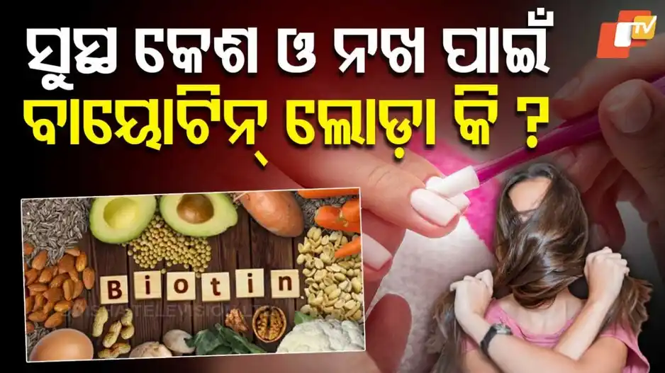 Image from OTV: *ସୁସ୍ଥ କେଶ ଓ ନଖ ପାଇଁ ବାୟୋଟିନ୍ - ଆବଶ୍ୟକ କି ଅନାବଶ୍ୟକ?🤔* *ଏହି ତଥ୍ୟ ...