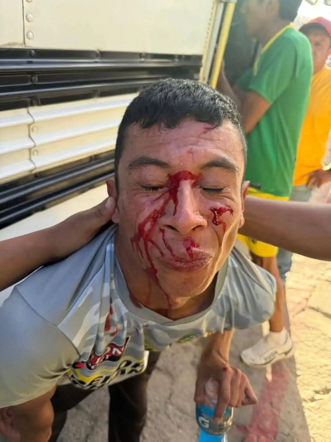 ⚽️ Afición X 🥅 post