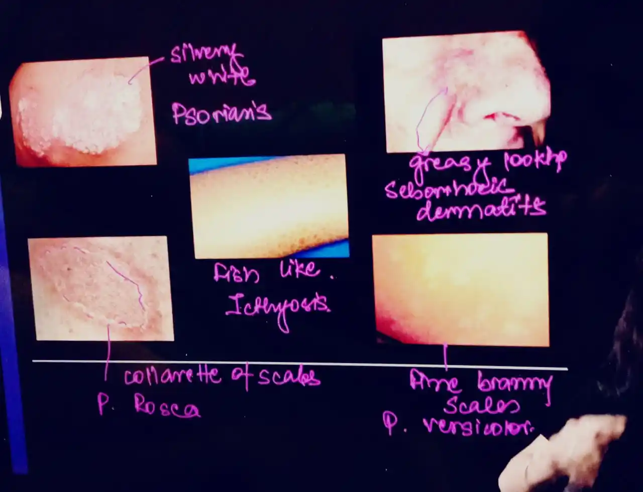 FMGE Most Expected Topic (Imp.PYT) post