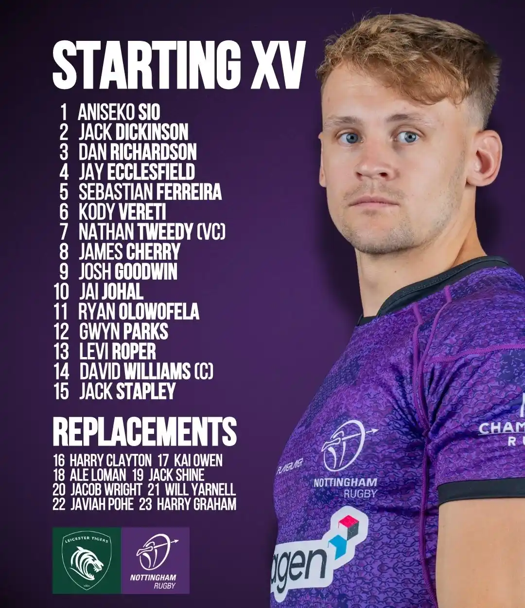 Nottingham Rugby post