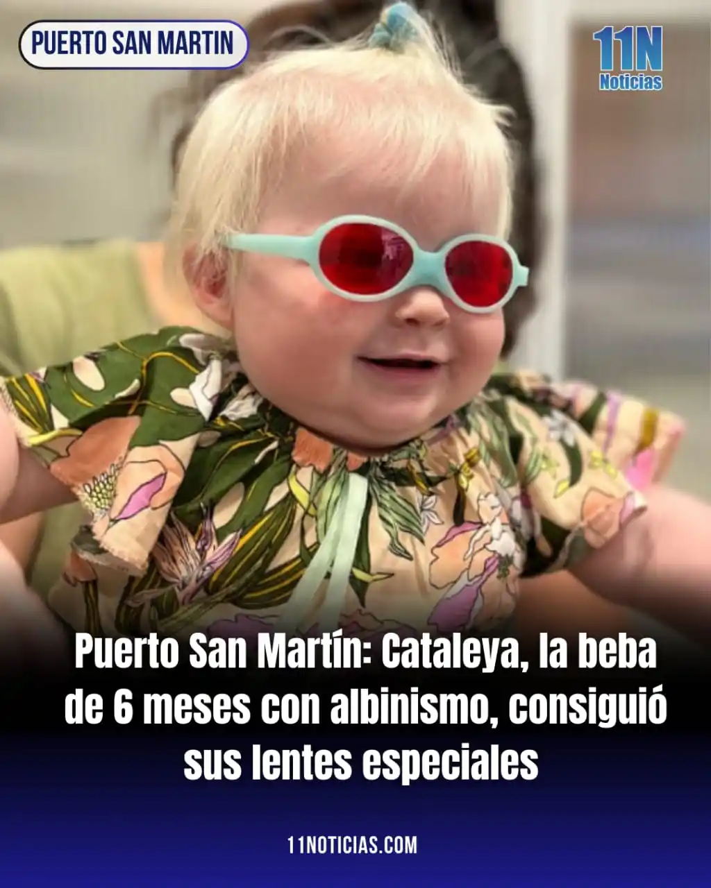 Image from 11Noticias: *Puerto San Martín: Cataleya, la beba de 6 meses con albinismo, consig...