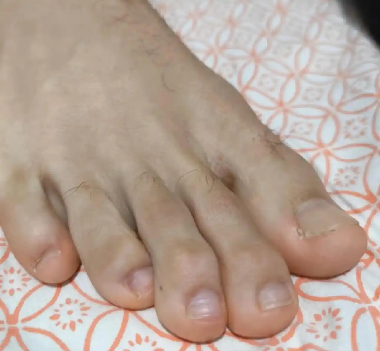 Arab’s Male Feet 👣 post