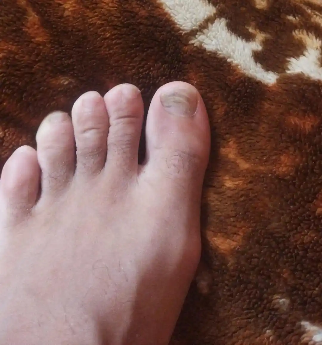Arab’s Male Feet 👣 post