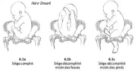 𝐇𝐢𝐫𝐨 𝐒𝐦𝐚𝐫𝐭 ✓ post