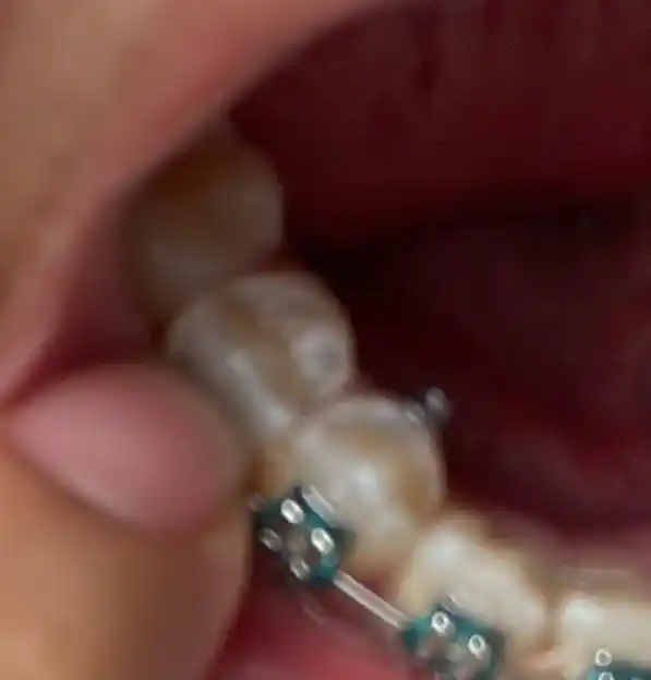 El bodrio de Sol 🗣️🔥 post