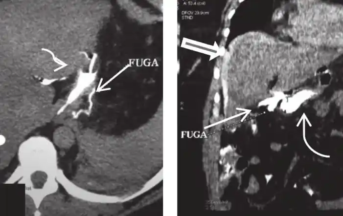 e-Radiologia post