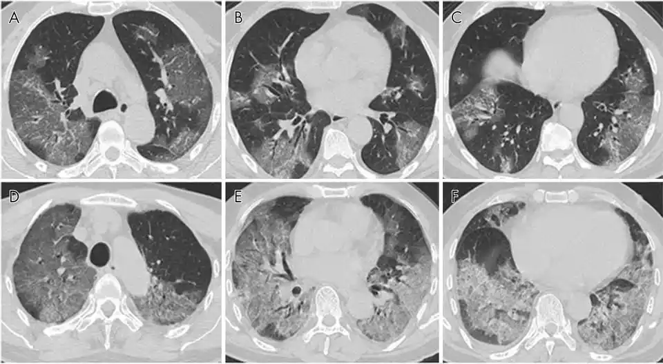 e-Radiologia post