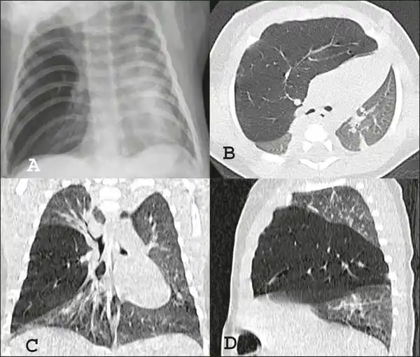 e-Radiologia post