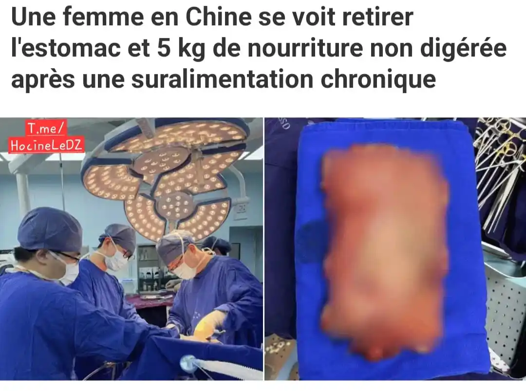 Image from Hocine Le DZ: 🇨🇳👀😱| 5 kg de nourriture enlevés à une Chinoise : Ils disent ici q...
