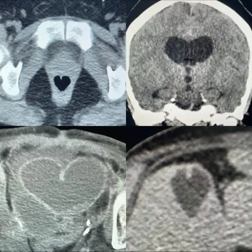 RadioGyan - Case based Radiology Learning post