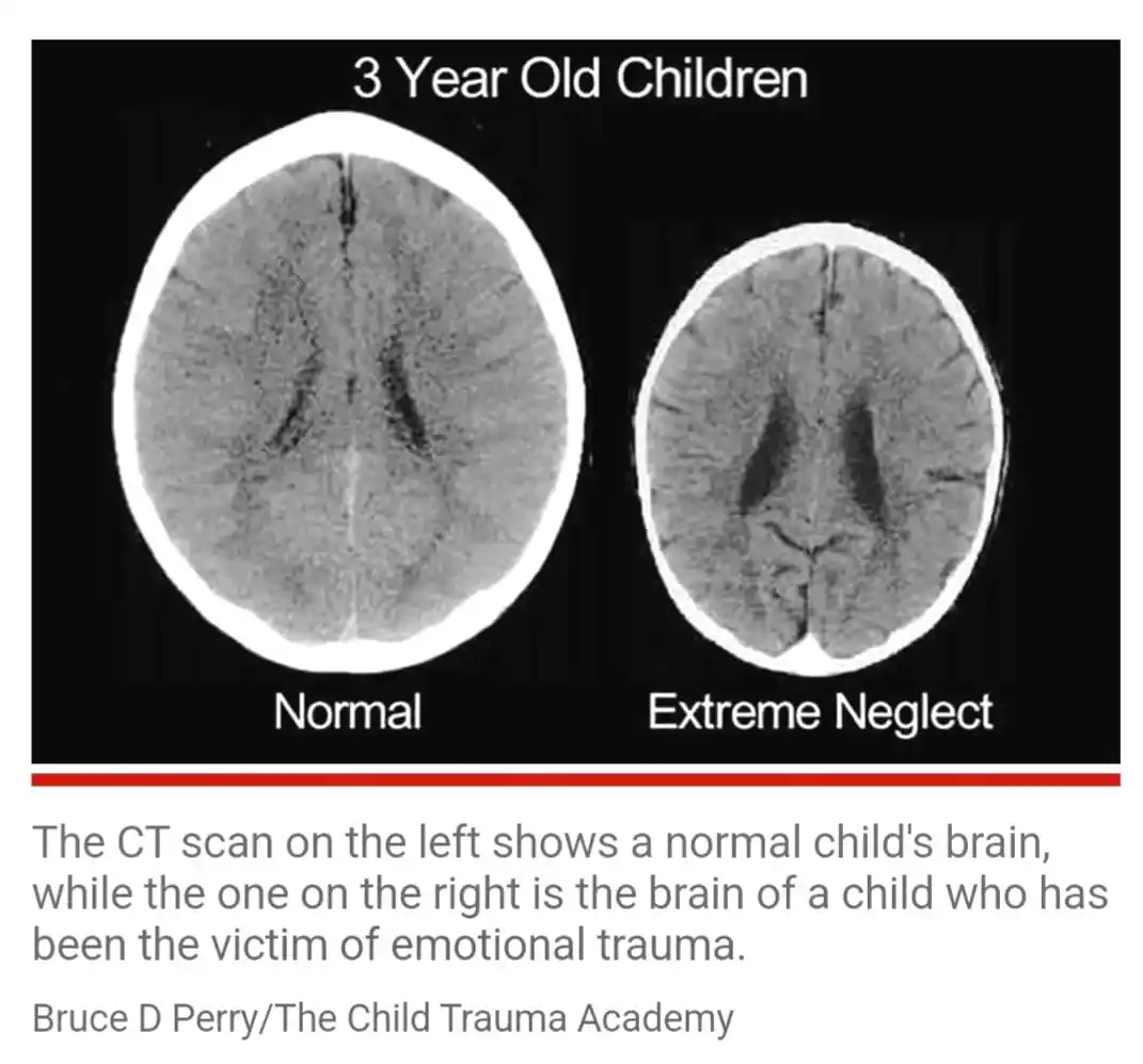 PARA - Neuroscience Ways of Mindfulness for Young Minds post