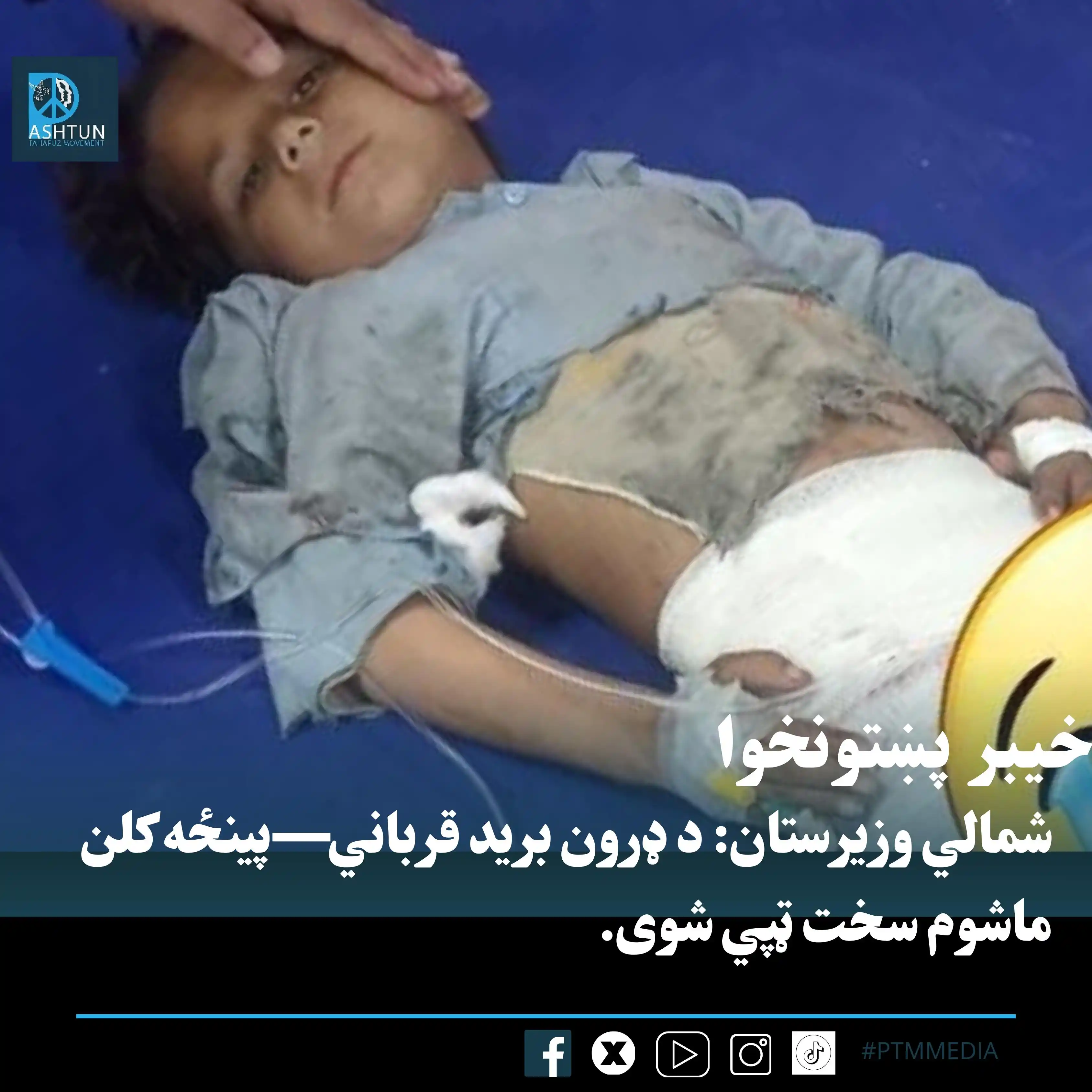 Image from PTM Dir Official: شمالي وزیرستان: د ډرون برید—پینځه کلن ماشوم سخت ټپي شوی. نن د شمالي و...